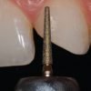 SISTEMA PARA PREPARACION DE HOMBRO KIT TES66