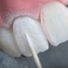 SISTEMA PARA ANATOMIA Y SUPERFICIE DE CERAMICA KIT TES79